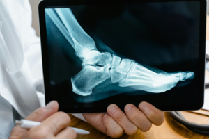 a person holding a tablet with a display of an X-ray